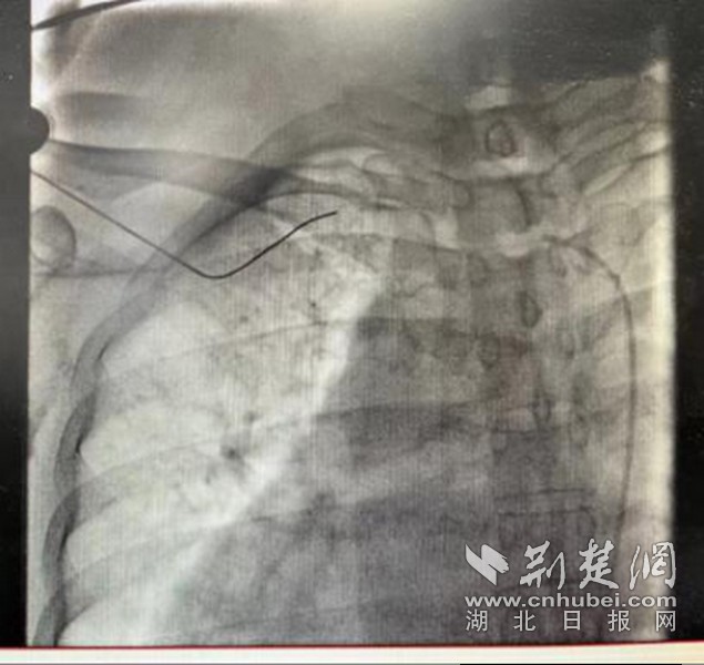 图片 3.jpg