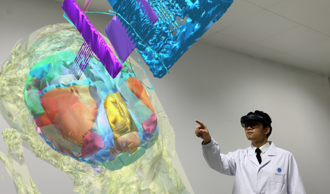 640?wx_fmt=png&from=appmsg