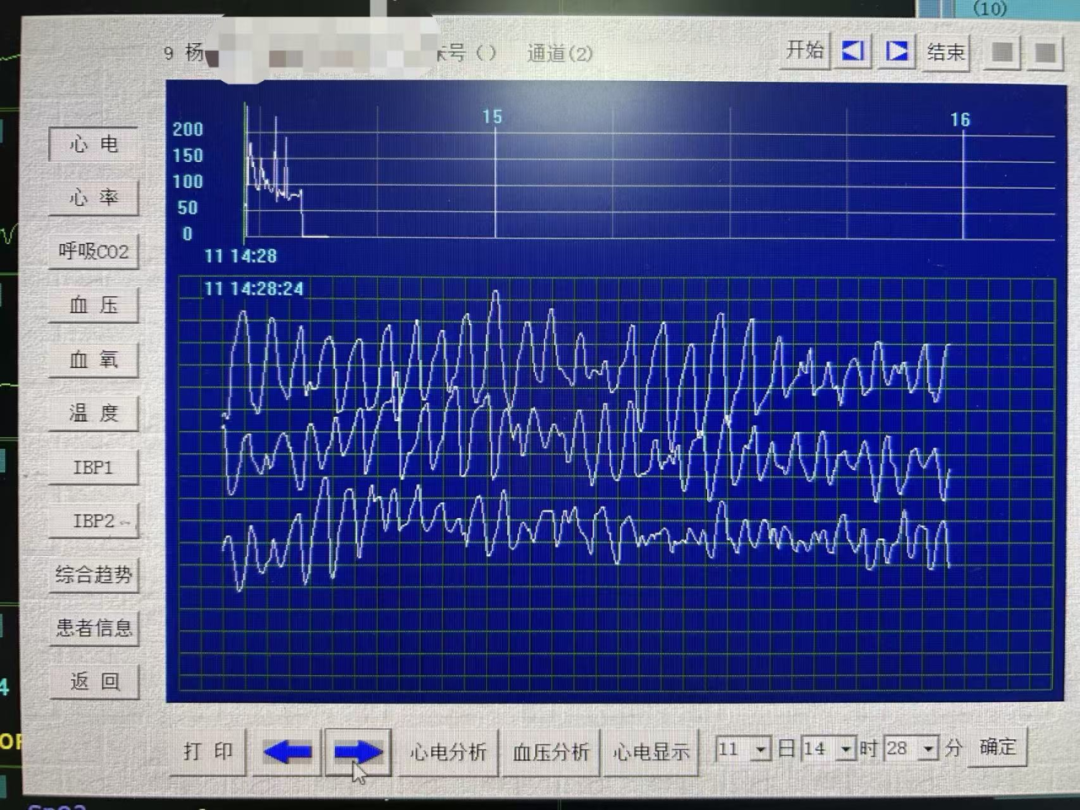 �������ڻظ��� �����۽��ۡ���׼ʶ�����Ҳ��������80�껼������