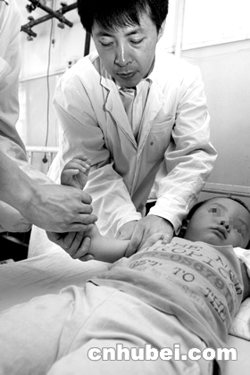 骨折患儿青睐中医手法复位(图)