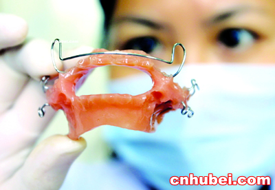 戴"口腔矫正器"止鼾(图)