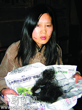 服装店营业员上班只几天 被人扯掉头发(图)