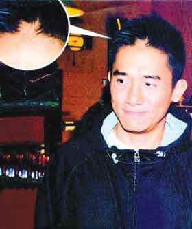 梁朝伟额头出现<em>大块</em>秃斑 记者<em>一</em>靠近就狂发火