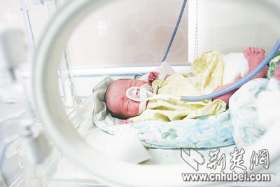 里躺着早产三胞胎 天价治疗费让父母犯愁(图)