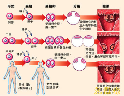 一人为<em>雌雄</em>同体<em>阴阳</em>人(图)