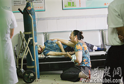 恶狗上街疯狂咬人 八旬太婆脸上缝了40针(图)