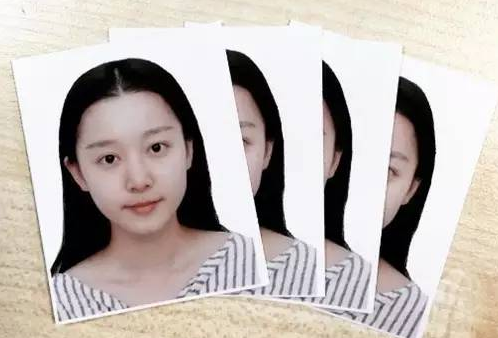 马龙女友被曝整容