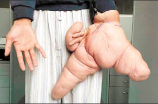 15岁少年54码大脚堪称脚神盘点全球畸形人图