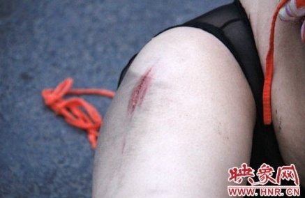 郑州裸奔女被爆有精神病:春光乍泄在街上裸奔自虐