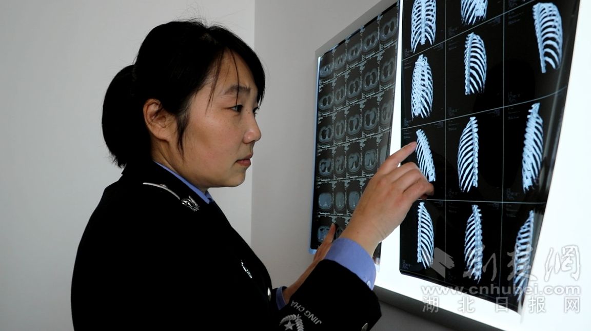 光荣!云梦公安女法医被公安部评为"成绩突出女民警"