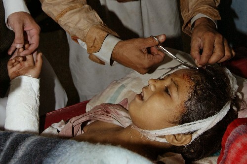 今年10月,南亚大地震中受伤的儿童