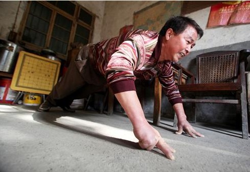 男子六指着地能做130多个俯卧撑 欲冲吉尼斯纪录