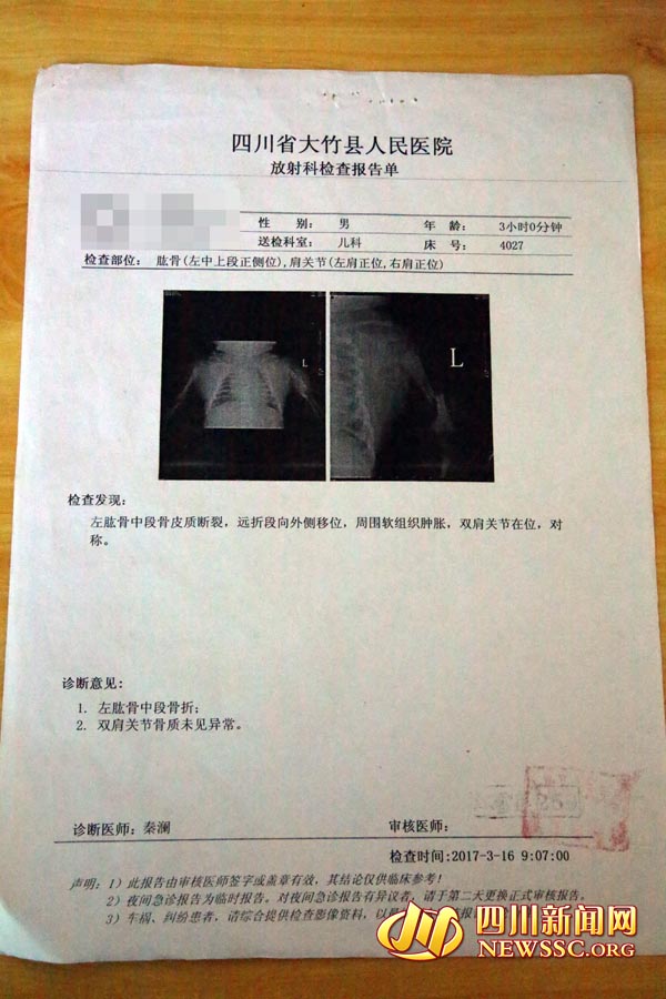 四川萌宝出生便"折翼" 何时才能拥抱父母(组图)_湖北日报网