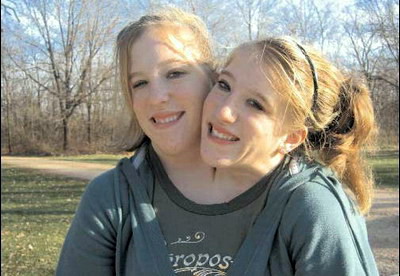 美国连体姐妹海量私照曝光:a爱喝牛奶 b爱喝橙汁