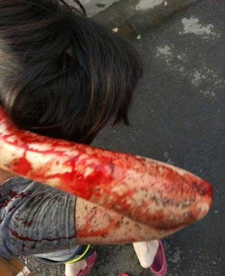 女子被袭胸后遭u型锁猛敲头部 受伤鲜血直流(组图)